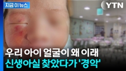 \'생후 4일\' 아이 얼굴에 선명한 상처...신생아실 미스터리 [지금이뉴스]