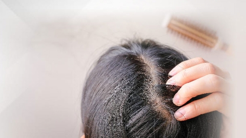 탈모 인구 2030 vs 405060 누가 더 많을까? 李 '탈모약 건보' 발언의 속뜻?