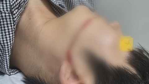 "고압 워터건 맞고 얼굴 50cm 상처"…안산 물축제 관계자 4명 송치