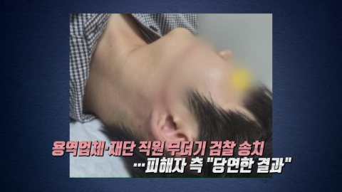 물축제 워터건에 피부 50cm 찢어져…용역업체·재단 직원 검찰 송치 [앵커리포트]