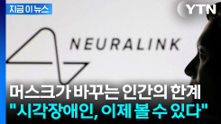 완전 실명도 시력 회복? 머스크가 바꾸는 인간의 미래 [지금이뉴스]