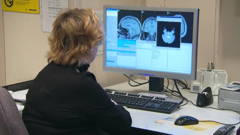 폐경이 뇌 회백질 감소 유발…여성이 치매 많은 이유?