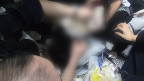  여객기에서 다른 승객 머리 폭행…상공에서 응급처치