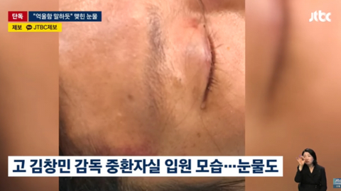 故 김창민 감독, 응급실 사진 공개, 눈물 맺힌 채 의식 잃어…父 "억울함 클 것"