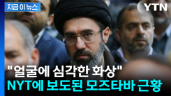 "얼굴에 심한 화상으로 성형수술 필요"...NYT가 보도한 모즈타바 근황 [지금이뉴스]