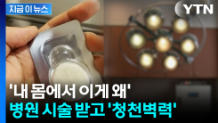 산부인과 시술 뒤 몸에서 \'충격\'...담당 의사, 뒤늦게 인정 [지금이뉴스]