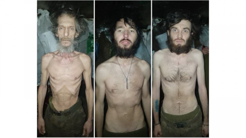 '영양실조' 우크라 병사 사진에 공분...보급 지휘관 해임