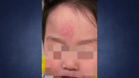 처음 본 2살 때려 \'뇌진탕\'…"악몽 같은 어린이날"