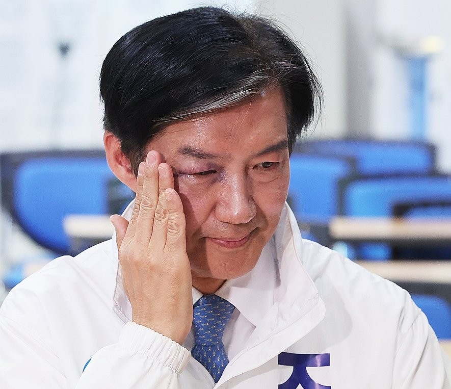 문에 부딪혔다는 조국...눈에 시퍼런 멍 든 채 후보 등록