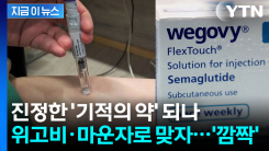 "무시하긴 어렵다"...위고비·마운자로 맞자 뜻밖의 항암 효과? [지금이뉴스]