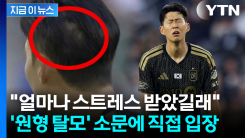 팬들 놀란 \'원형 탈모\' 논란에...손흥민이 직접 올린 사진 [지금이뉴스]