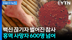 홍역 대유행 비상...방글라데시서 600명 넘게 숨졌다 [지금이뉴스]
