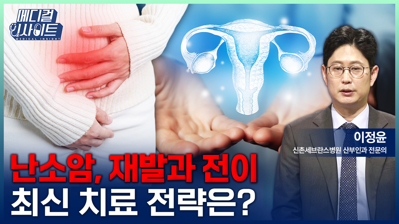 [메디컬 인사이트 144회] 진행성·재발성 난소암의 최신 치료법