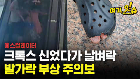 크록스 신었다가 날벼락…발가락 절단 주의보 [여기,잇슈]