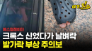 크록스 신었다가 날벼락...발가락 절단 주의보 [여기,잇슈]