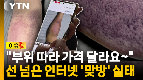 "어디 때릴지 골라주세요"...'8시간에 1,300대' 부위 가격표까지 [이슈톺]