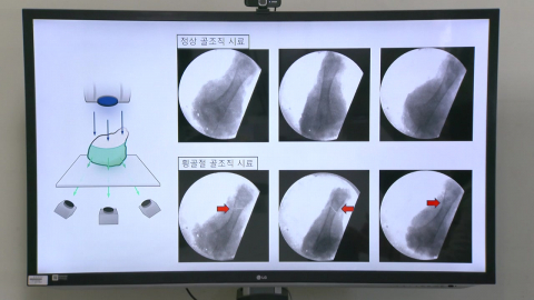 "CT 없이 입체진단 가능"…비법은 '한지' 기반 필름