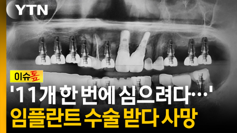 '11개 한 번에 심으려다...' 임플란트 수술 받던 70대 심정지 [이슈톺]