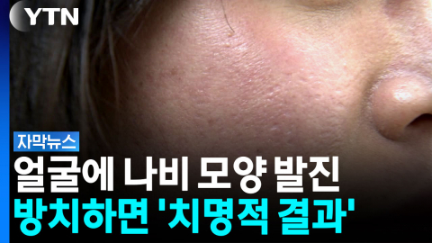이 증상 가만히 뒀다간 '큰일'...장기 망가진다 [자막뉴스] 