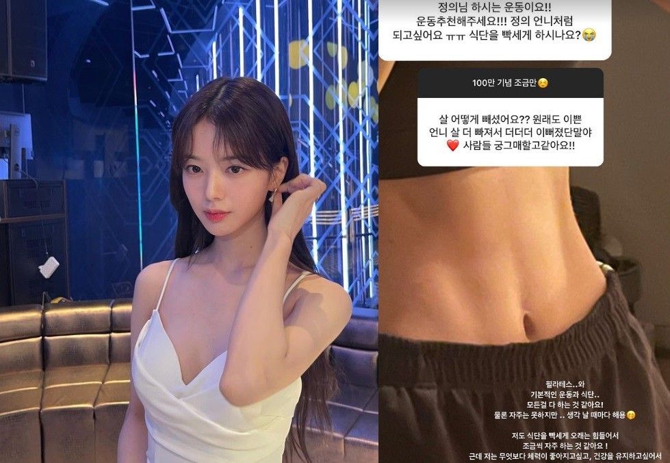 거식증 의심된다는 노정의 현재 모습