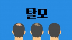탈모가 걱정된다면 이렇게!