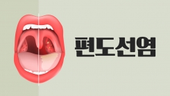 목감기에는 아이스크림이 좋다?