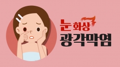 선글라스 렌즈 짙을수록 좋다?