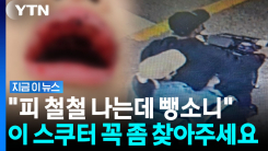 "저희 딸 치고 도망간 뺑소니범 좀 찾아주세요"…스쿠터 타고 사라진 2명 [지금이뉴스]