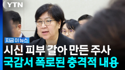 복지부도 고개 숙였다…시신 피부 조직으로 만든 미용주사 \'우후죽순\' [지금이뉴스]