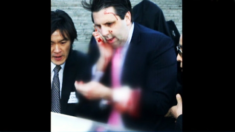 US Ambassador to Seoul Lippert injured in assailant's attack